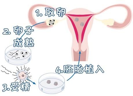 单身同志供卵公司